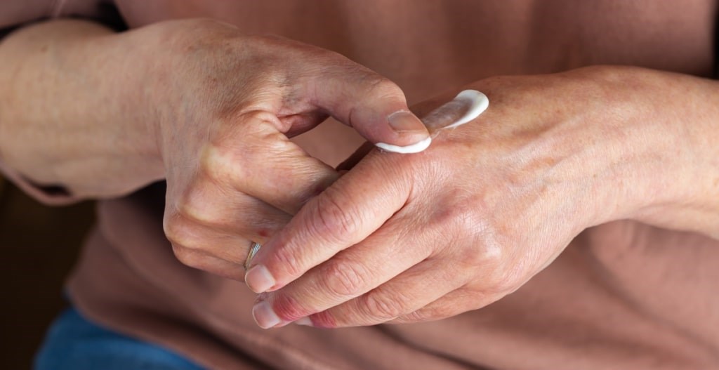 Atopic Dermatitis (Eczema)
