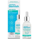 Bye Bye Blemish - 肌肤救援精华液 30mL