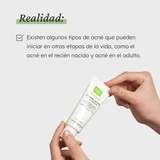 Martiderm