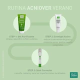 Martiderm