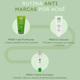 Martiderm