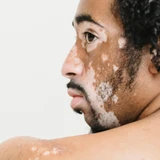 Sesderma