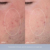 Dermalogica