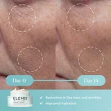 Elemis