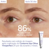 Caudalíe