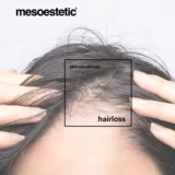 Mesoestetic