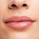 Bioderma