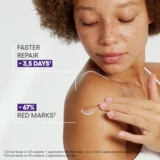 A Derma