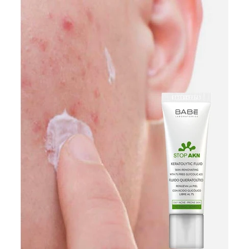 Babé