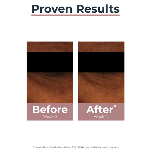 Eucerin
