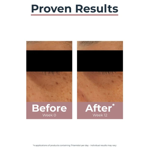 Eucerin