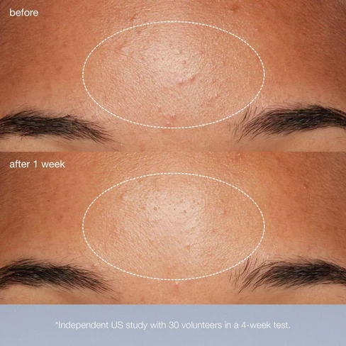 Dermalogica