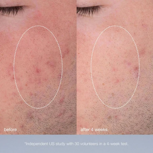 Dermalogica