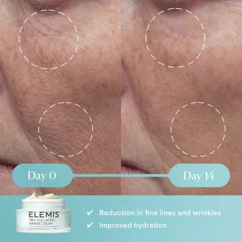 Elemis