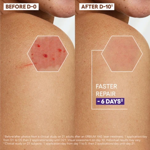 A Derma