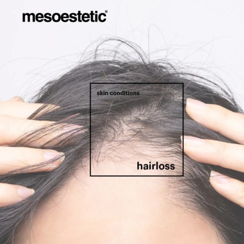 Mesoestetic