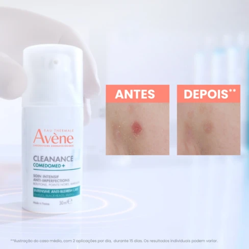 Avène