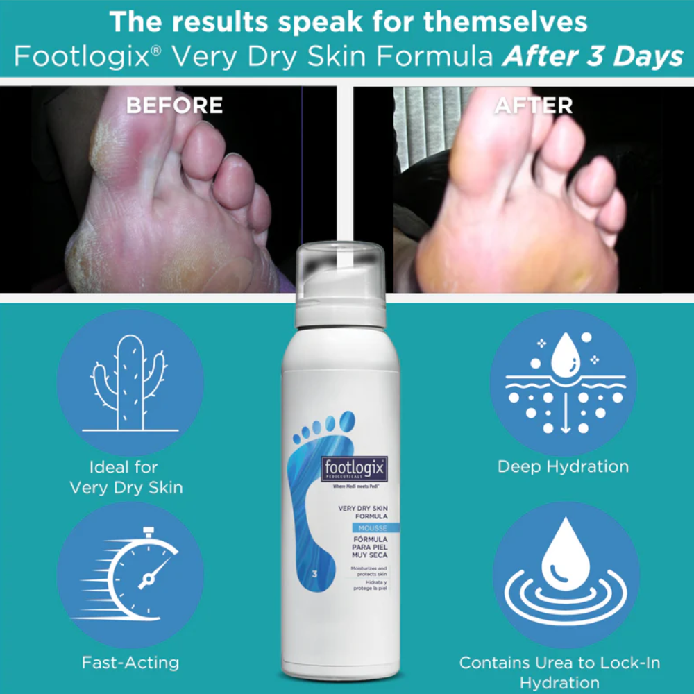 Very Dry Skin Form Protection for Dry Skin - Footlogix | Buy at ...